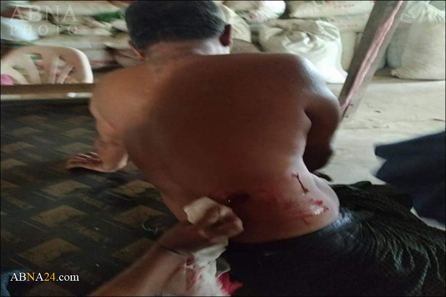 ပဲခူးတြင္ အၾကမ္းဖက္စစ္အုပ္စု ပစ္ခတ္မႈေၾကာင့္ ၂ ဦးေသဆုံး၊ ၆ ဦးဒဏ္ရာရ