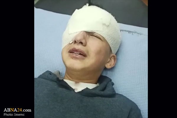 Palestinian child loses his eye by Israeli bullet in Al-Khalil