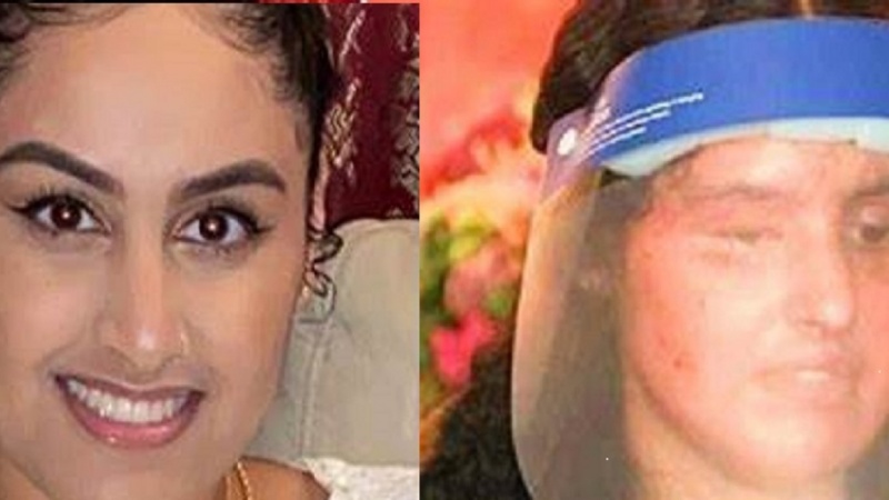 امریکی پولیس پاکستانی نژاد مسلم لڑکی کے چہرے پر ایسڈ پھینکنے والے مجرم کو گرفتار کرنے میں ناکام