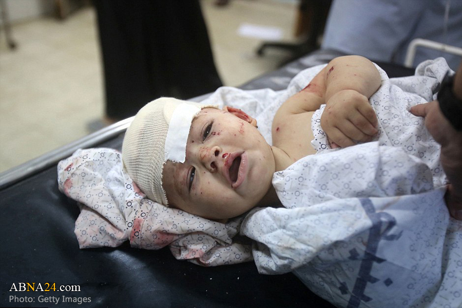One-year-old among 29 children injured in Israeli aggression in al-Quds: UNICEF
