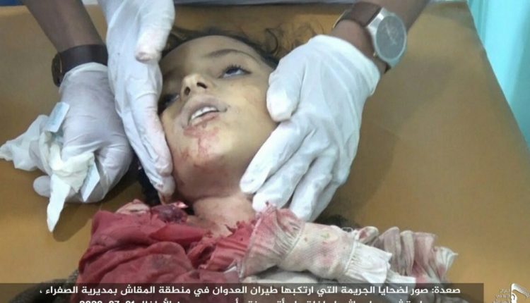 Saudi shelling on Yemen's Saada; 3 children martyred 