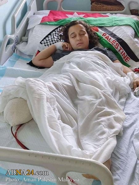 Ампутация ноги палестинской девушки из-за серьезности травм в результате сионистского нападения + Фото