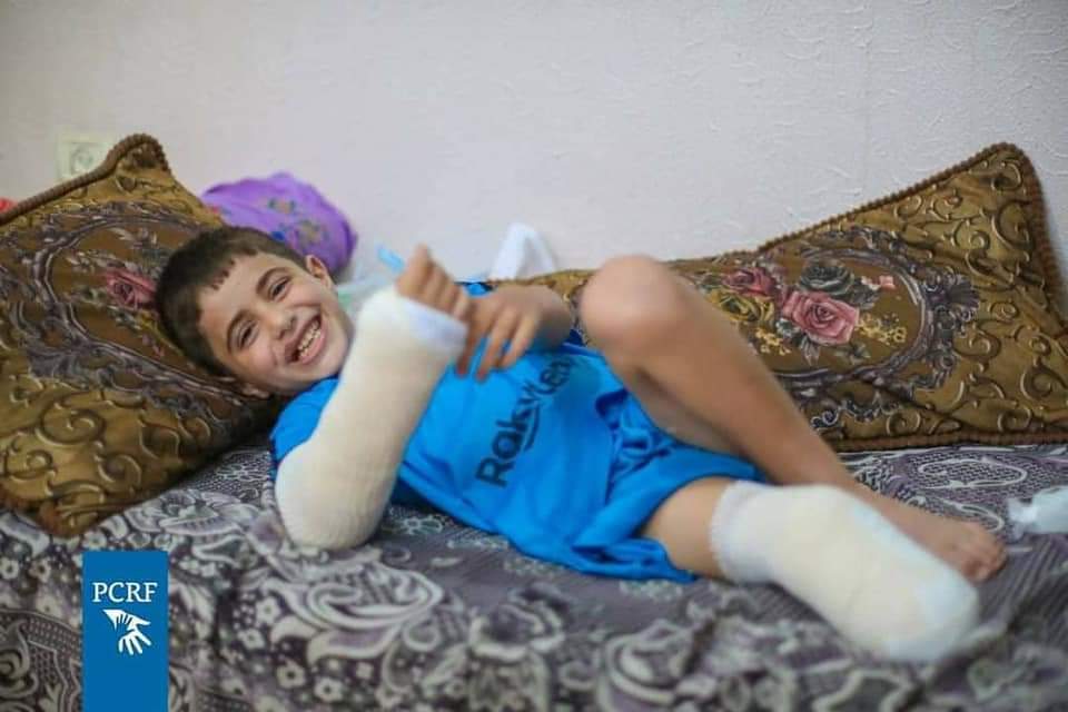 Photos: A Palestinian child smiling while lost his leg in Israeli aggression on Gaza