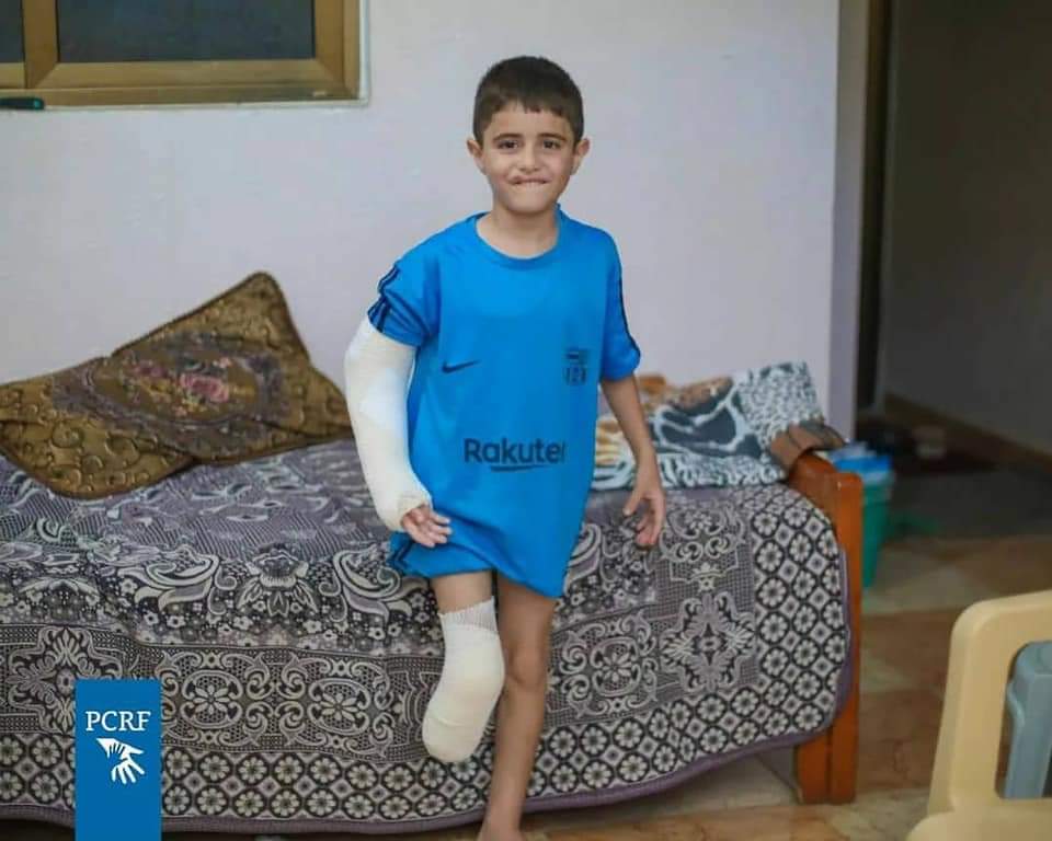 Photos : Un enfant palestinien souriant alors qu'il a perdu sa jambe lors de l'agression israélienne contre Gaza