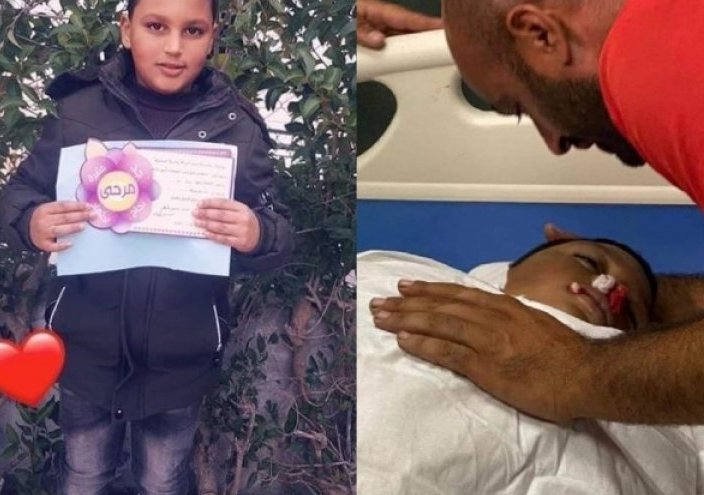 استشهاد طفل فلسطيني متأثرا بإصابته في الضفة الغربية