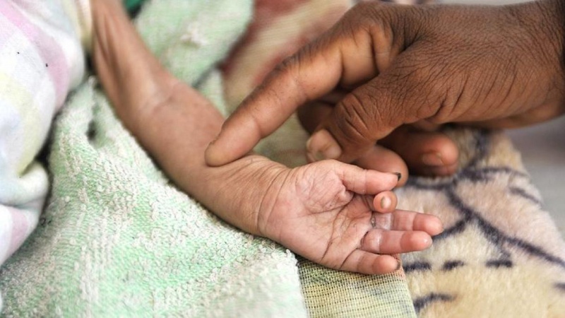 ユニセフ、「10分毎にイエメン人の子ども1人が死亡」