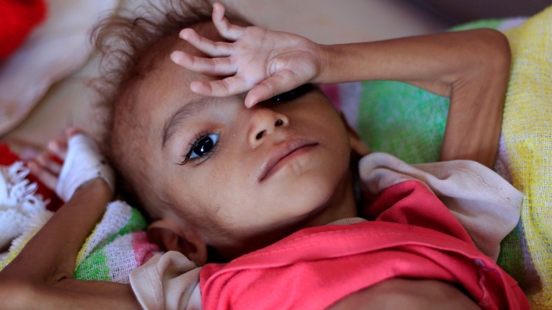 UNICEF: Alle 10 Minuten stirbt ein jemenitisches Kind