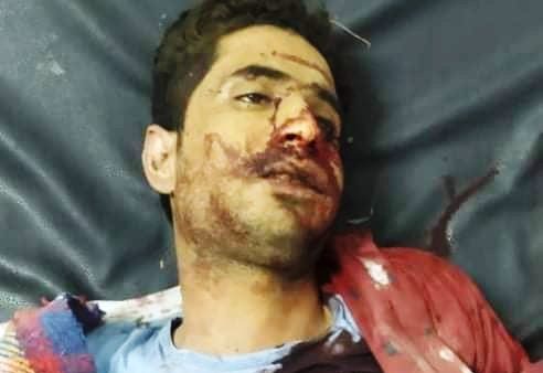على طريقة جريمة السنباني.. مليشيا “الانتقالي” تقتل أحد أطباء بلا حدود في لحج