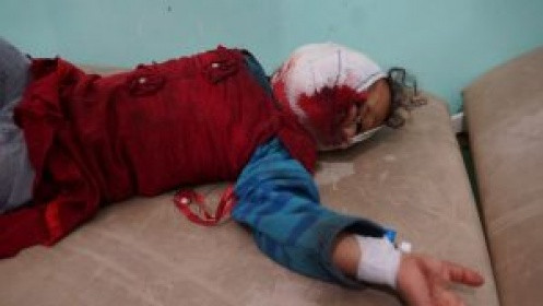 جريمة سعودية جديدة في صعدة ضحيتها 5 مدنيين بين شهيد وجريح