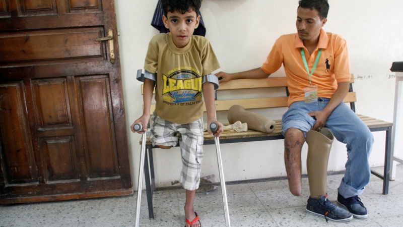 Saudi-funded hospitals in Yemen performed unnecessary amputations
