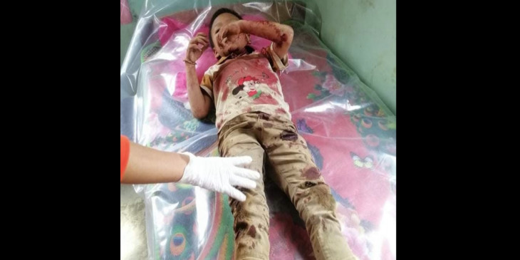 မိုးၿဗဲတြင္ စစ္တပ္က လက္နက္ႀကီး ျဖင့္ပစ္ခတ္ သျဖင့္ အမ်ိဳးသမီး ၁ ဦးေသ၊ ကေလးမ်ား အပါအဝင္ ၆ ဦး ဒဏ္ရာရ