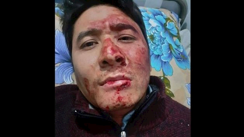 IRIB cameraman comes under attack in Kabul
